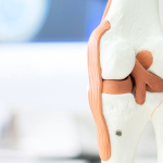dolor de rodilla